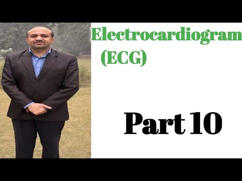 Electrocardiogram(ECG)::How To Calculate Heart Rate From ECG(Method 4)