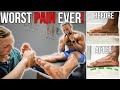 The WORST PAIN! | Fixing 28 YEARS Of Flat Feet!