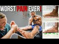 The WORST PAIN! | Fixing 28 YEARS Of Flat Feet!