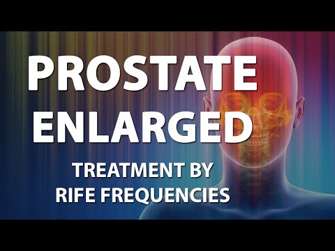 Brachiterapia prostatica g Obninsk Trattamento popolare di cancro alla prostata