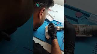 replacement of broken crystal for Diode laser hair removal #repair#diodelaser#hairremoval #tool