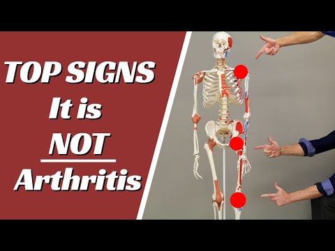 Artritisz artrózis boka tünetei és kezelése