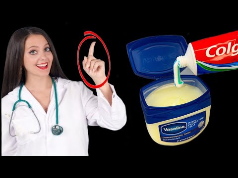 Mix Vaseline with colgate and after 2 hours you will be surprised with the results