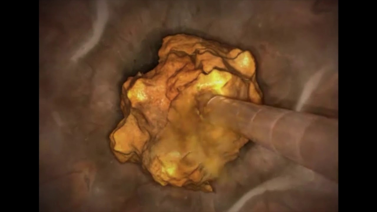 Gerardo Rodrigo Lemus Mena-16