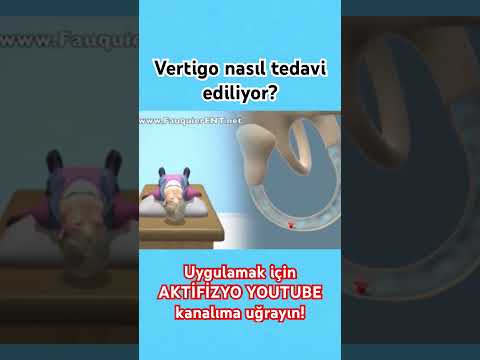 Vertigo - dizziness treatment #aktifizyo #physicaltherapy #vertigo #dizziness