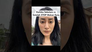 Download lagu Kulitku Sebelum vs Setelah STOP Makan Gula | dr. Clarin Hayes,MBiomed(AAM) mp3