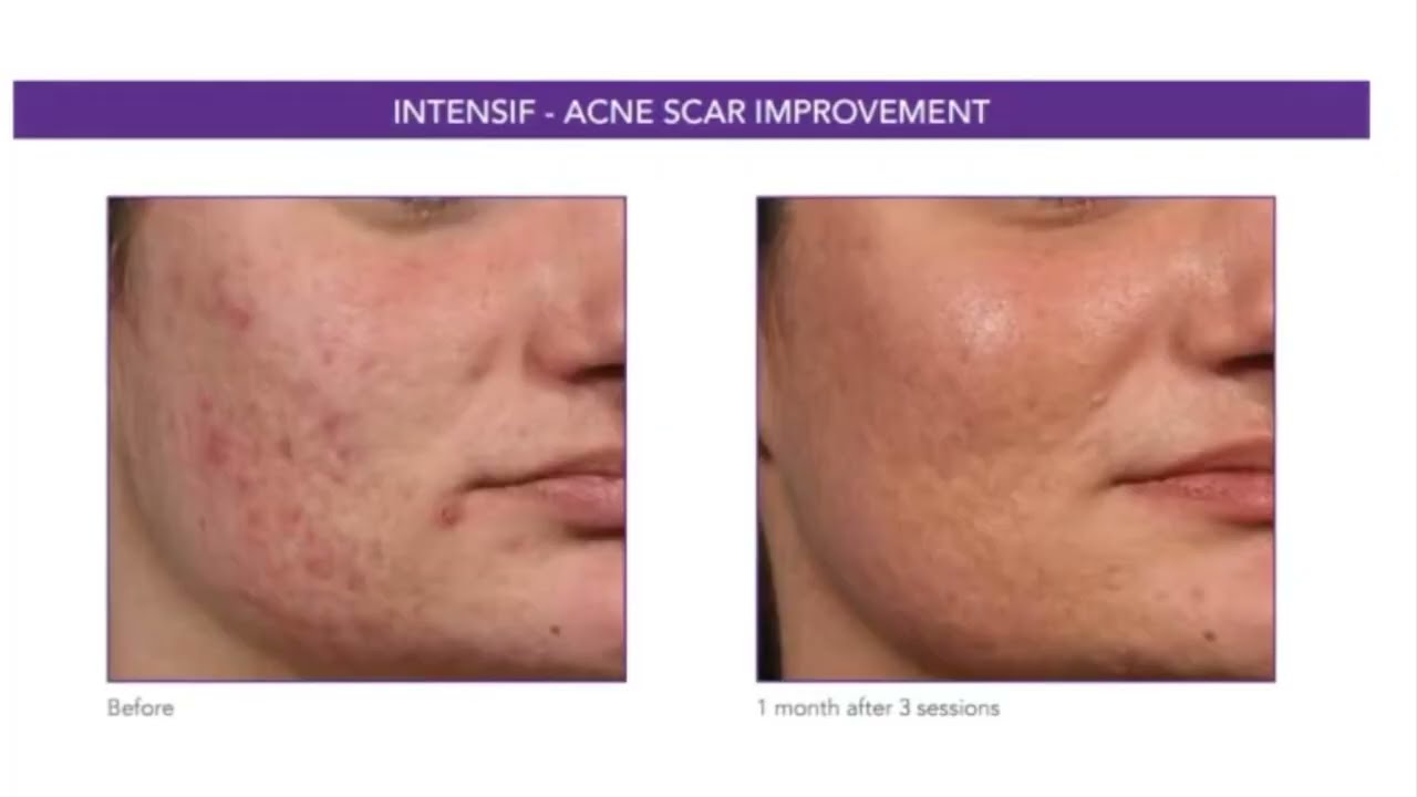 Stella Villarreal Garza-39