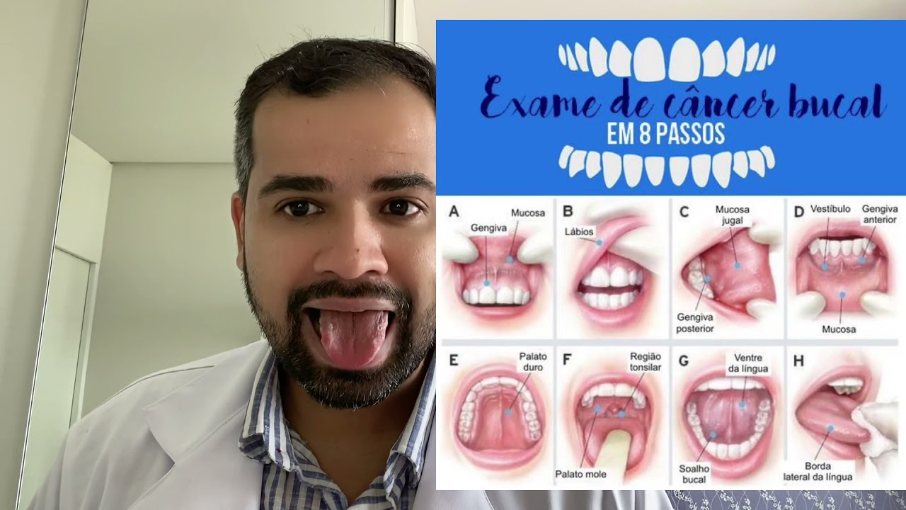 Francisco De Assis Almeida Lima Júnior-88