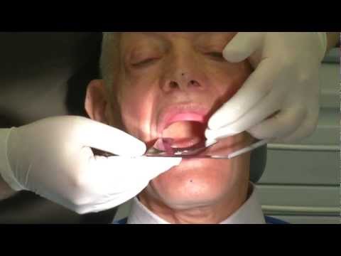 Candulor Registrierset CRS 10