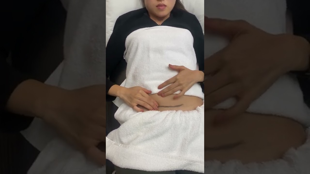Post Partum Pelvic Physiotherapy - C-Section Scar Mobilization