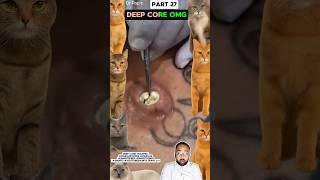 Deep Core Trapped #pimplepopper #pimples #shortsfeed #shortvideo #skincare #educational #shorts