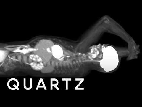 Medical scanner takes 3D images of the whole body at once