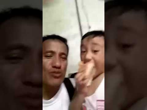 Makakaapekto ba ang L-carnitine upang mawalan ng timbang nang walang ehersisyo Dumukwang marks sa abdomen upang alisin ang laser review