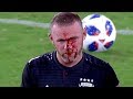 THE WORST FOULS & INJURIES IN FOOTBALL!!