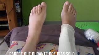 Primera semana después de la operación de extracción de placas de tibia y peroné. #19