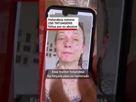 Holandesa remove mais de 250 tatuagens feitas por ex-namorado abusivo
