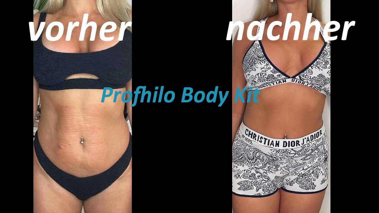 PROFHILO BODY KIT/ Bauch Straffung