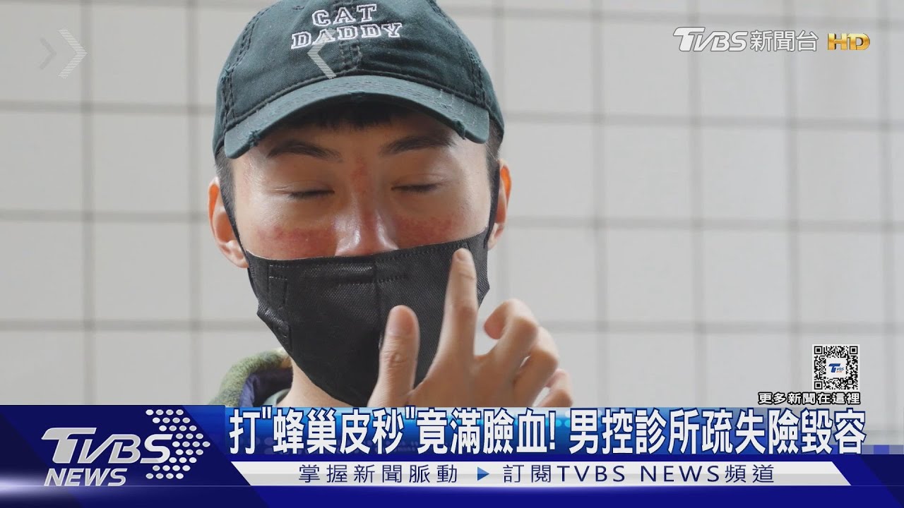 打「蜂巢皮秒」竟滿臉血! 男控診所疏失險毀容