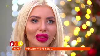 Polska Barbie o swoich operacjach – PnŚ