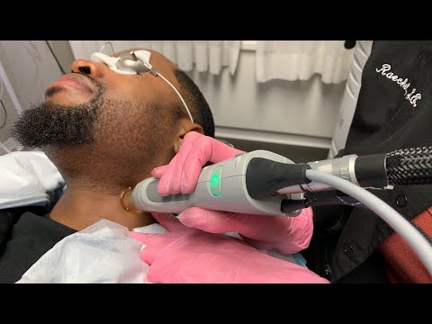 Candela Laser | Hair Removal with Safaree | New York,...
