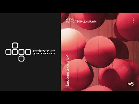 PREMIERE: VegaZ SL - Endometriosis (NOIYSE PROJECT Remix) [Transensations Records]