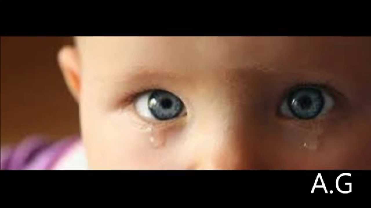 Ребенок температура слезятся глаза. Детские глаза. Глаза гноятся и слезятся у ребенка.