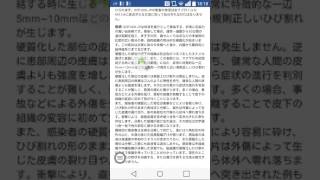 SCP-008-jp「伝染性柱状節理」皮膚だけは砕けない