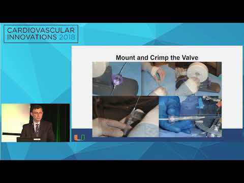 CVI2018 Session: Antegrade TAVR - Mauricio Cohen, MD