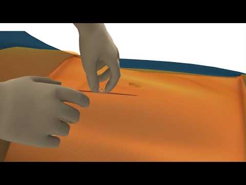 3M™ Ioban™ 2 Antimicrobial Incise Drape