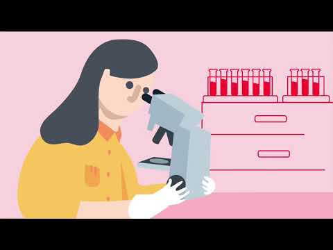 Hypertrophic cardiomyopathy (HCM)