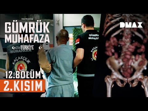 Yolcunun Midesinde Yasaklı Madde Yakalandı | Gümrük Muhafaza Türkiye 12. Bölüm 2. Kısım
