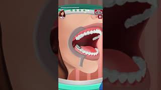 Download lagu Adjustment of third and fourth molars ,surgery animation ASMR  |zuni tv| mp3