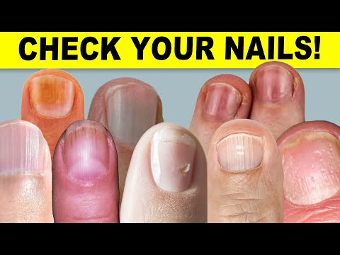 9 Things Fingernails Can Tell You About Your Health