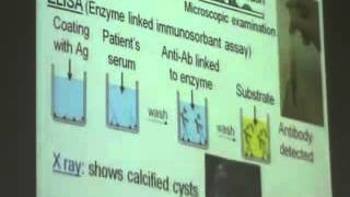 Dr Azza 14 11 12 2014   YouTube