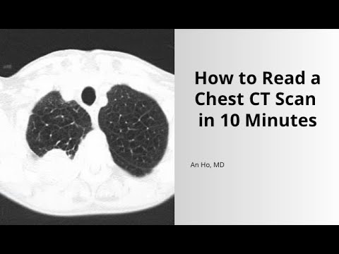 How to Read a Chest CT Scan in 10 Minutes