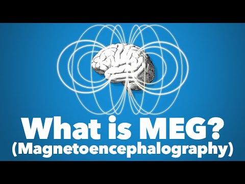 image-What is MEG method?