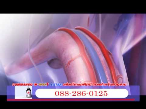 ผลกระทบ finlepsin ในความแรง ผู้หญิงเชื้อโรคเสียงฟังออนไลน์