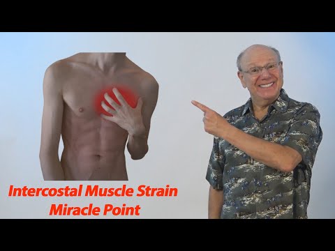 Intercostal Muscle Strain Miracle Point