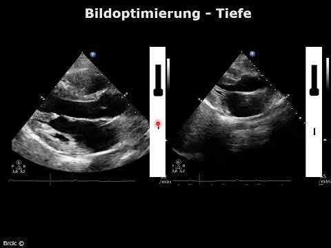 01   Einführung in die TTE 2022