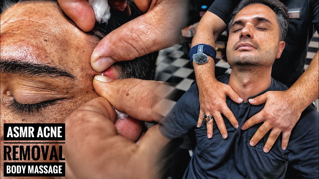 ASMR Head Massage & Satisfying Acne Removal | Deep Relaxation | Sleep time