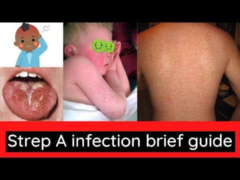 Strep A (Scarlet fever) infection information for patients.