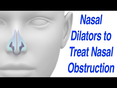 Nasal Dilator to Treat Nasal Obstruction without Meds, Surgery, or Breath Right Strips