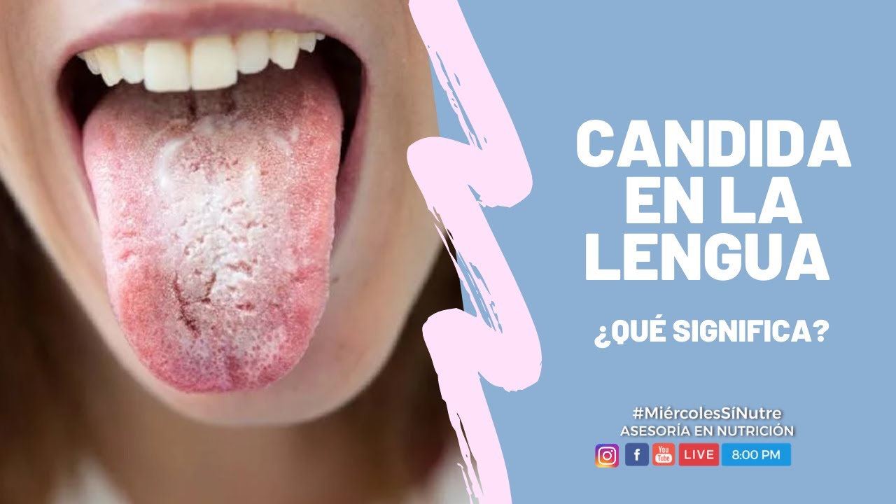 Cándida en la lengua, ¿qué significa