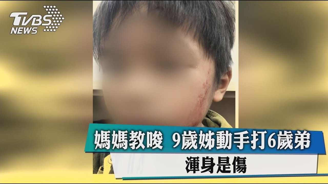 媽媽教唆9歲姊動手打6歲弟 渾身是傷