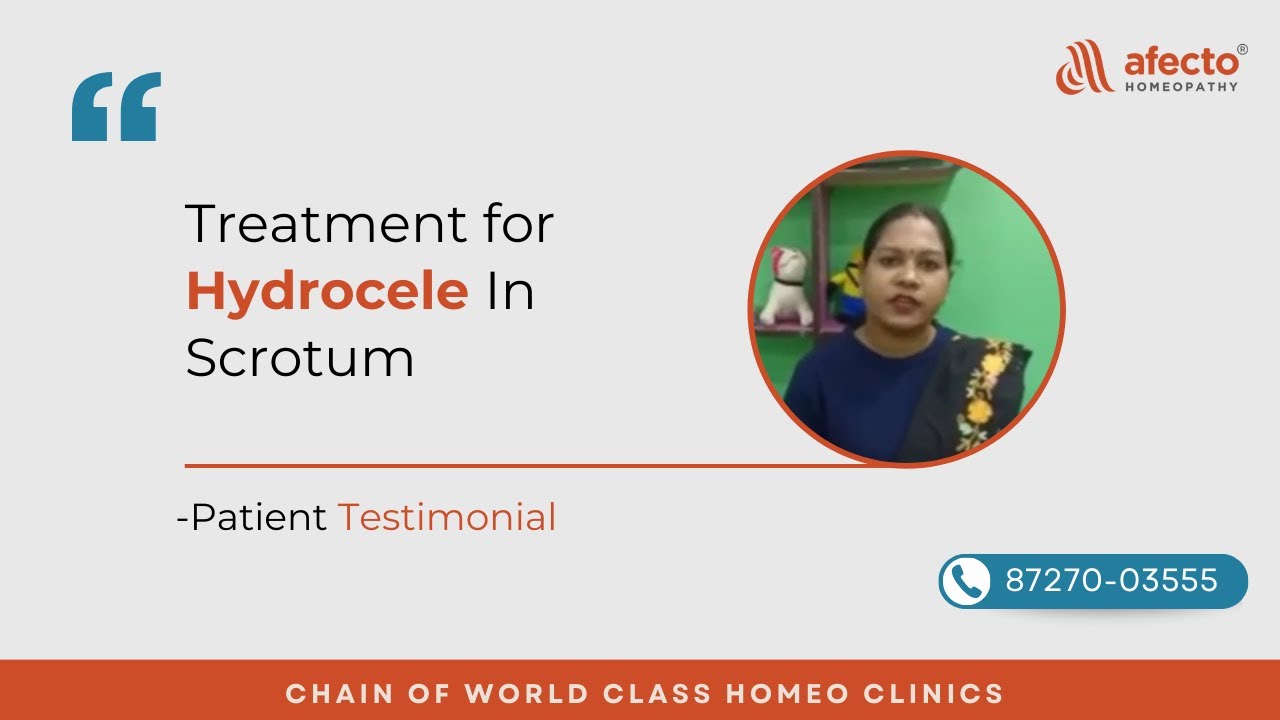 Successful Hydrocele In Scrotum Treatment | Patient Review