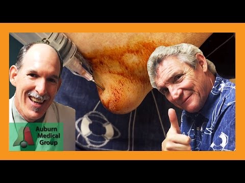 Chlamydia zerstören Gelenke Wund links Gott und zurück