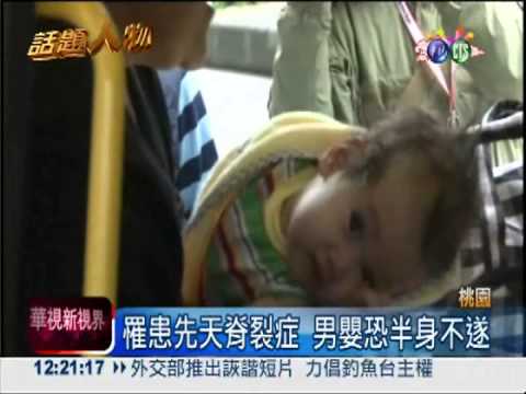 先天脊裂症 諾魯男嬰來台就醫