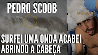Surfei uma onda acabei abrindo a cabeça Pedro Scoob