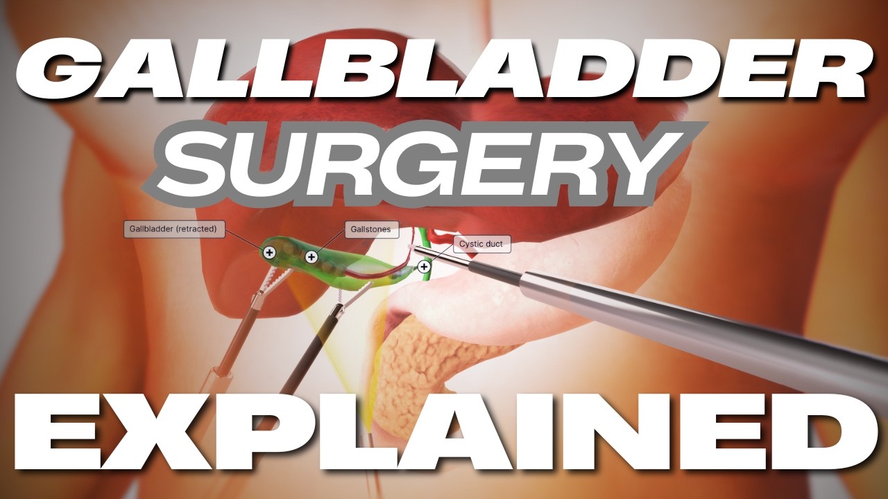 Gallbladder Surgery Explained - Complications and Recovery