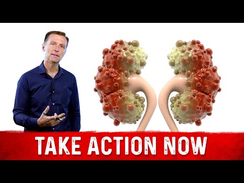 The Top SUPERFOODS for the Kidneys—Explained by Dr Berg